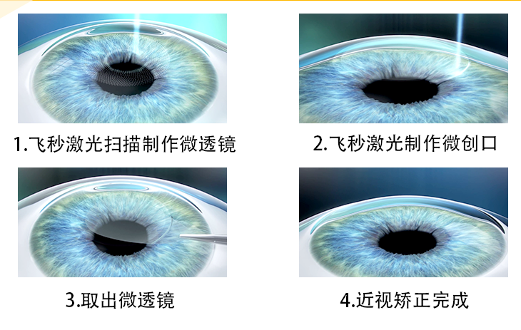 图层 3(1).png