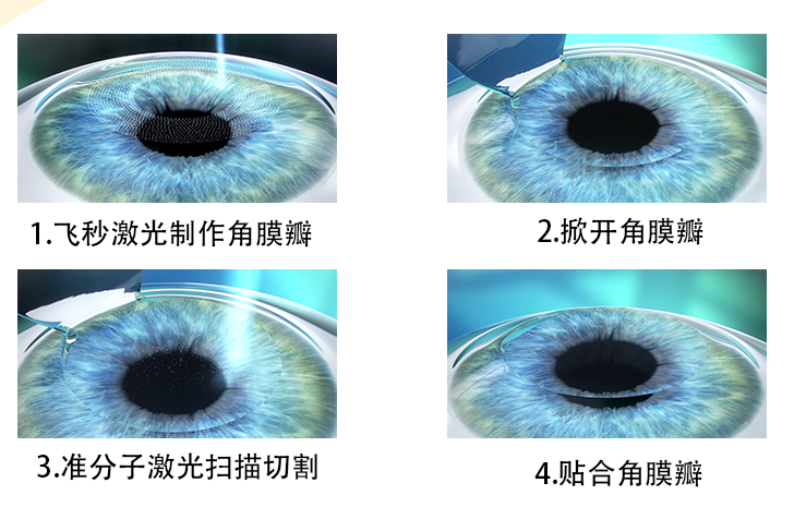 图层 4(1).png